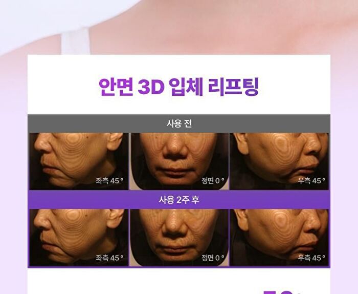 Bioheal Boh Probioderm 3D Lifting Cream Mask Set - 35g x 6 sheets