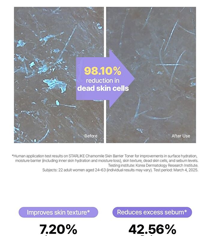 Chamomile Skin Barrier Toner - 210ml