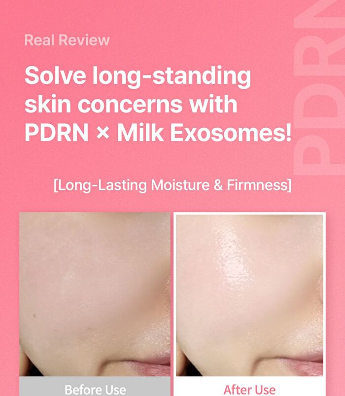 PDRN Exosome Hydro Ampoule - 30ml