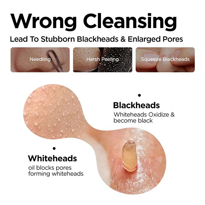 Focalskin Blackhead Remove Toner - #Toner - 100ml