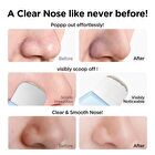 Focalskin Blackhead Remove Toner - #Toner - 100ml