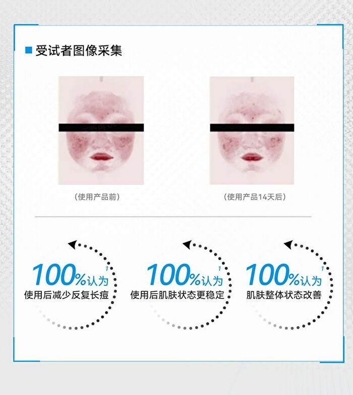 Redness Relief & Acne Removal Essence - Set (1.5ml x 30pcs)