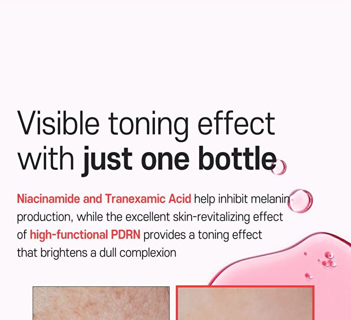 TXA 5 Niacinamide 10 Dark Spot Glow Serum - 30ml