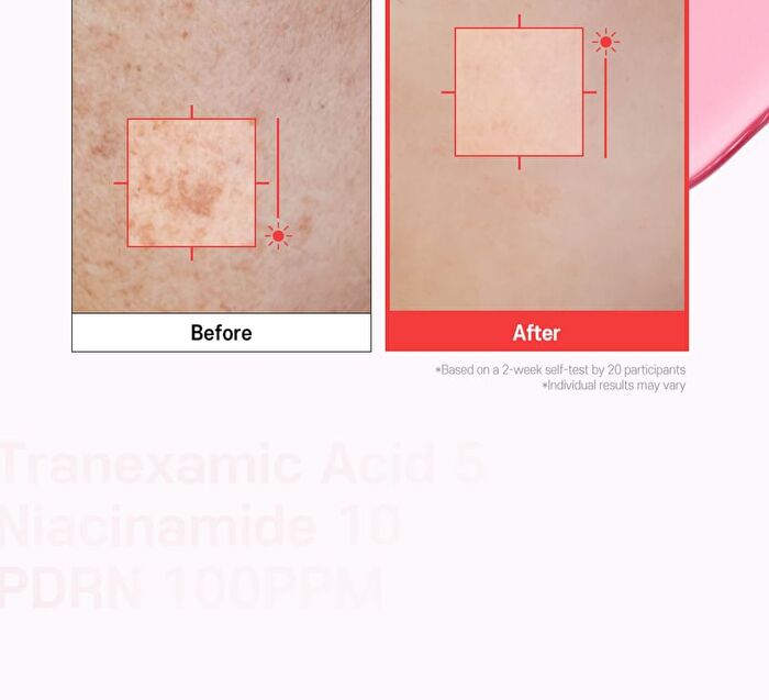 TXA 5 Niacinamide 10 Dark Spot Glow Serum - 30ml