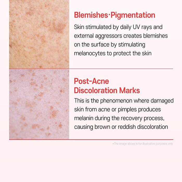 TXA 5 Niacinamide 10 Dark Spot Glow Serum - 30ml