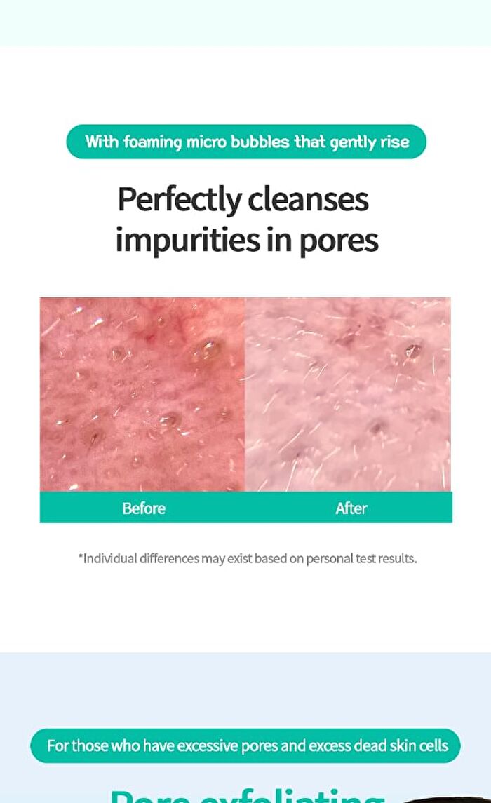 Facial Wash Bubble Mask Set - 2 Types - Cica