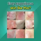 Hyaah All-In-One Ectoin Lotion - 100ml