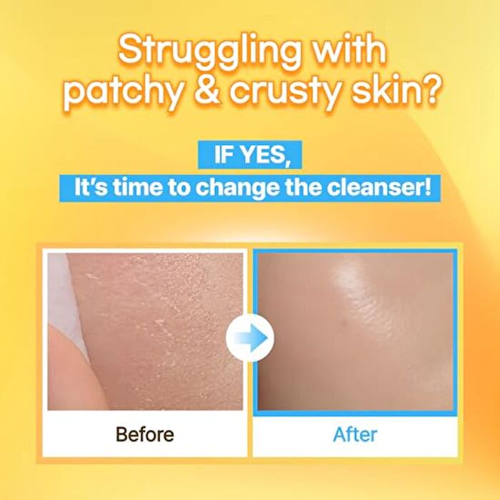 Hyaah Mild But Deep Cleansing Water - 300ml