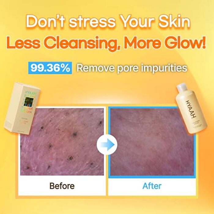 Hyaah Mild But Deep Cleansing Water - 300ml