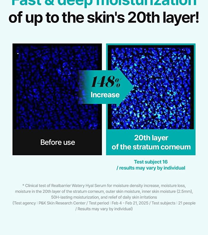 Watery Hyal Serum - 50ml