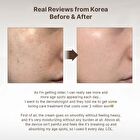Melajuran Toning Device - 1 set