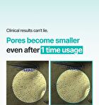 Pore-Thera Shot Minimizer - 1 set
