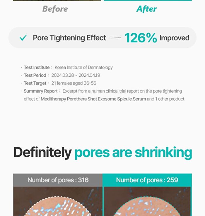 Pore-Thera Shot Minimizer - 1 set