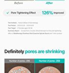 Pore-Thera Shot Minimizer - 1 set