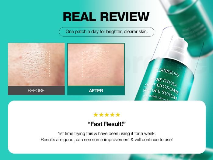 Porethera Shot Exosome Spicule Serum - 38ml