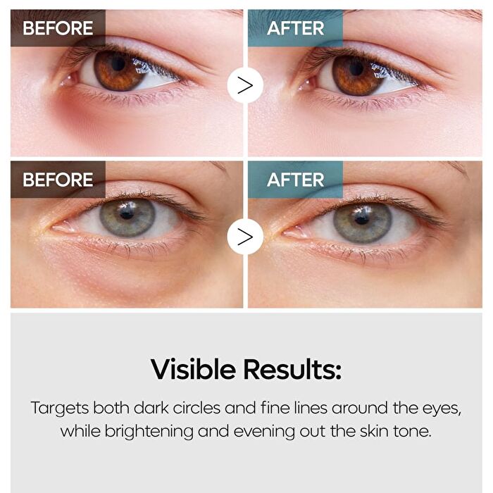 TX Retinalsome Double Effect Eye Cream - 40g
