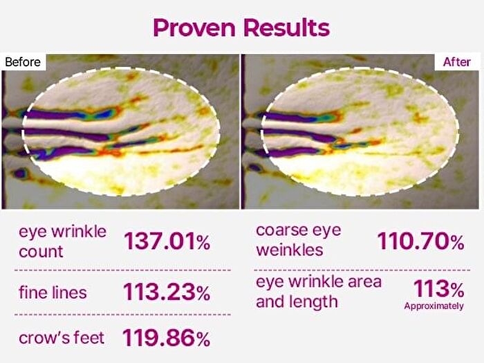 Cemenrete Calcium Volume Eye Patch - 2026 Version - 72g x 60 pcs