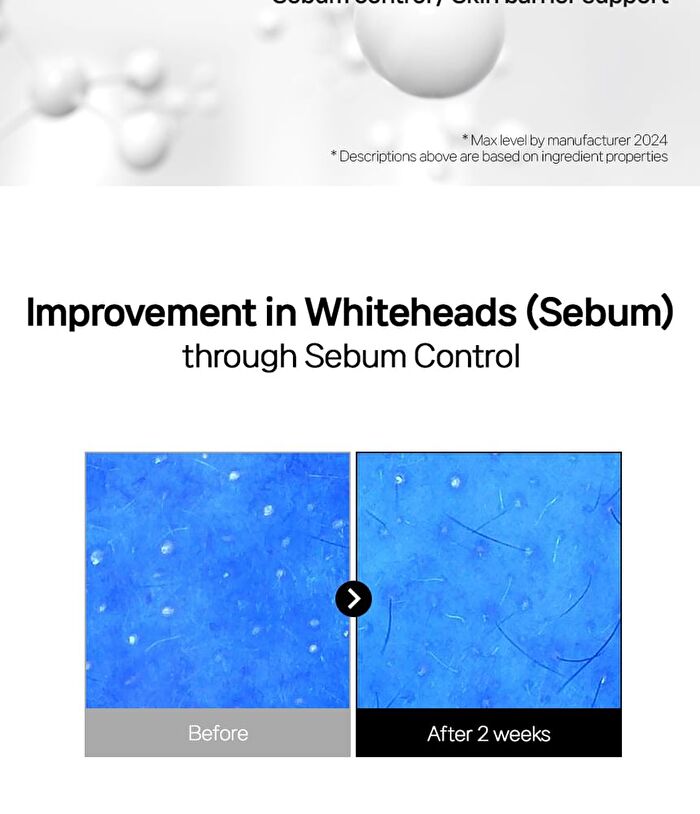 Niacinamide 21 Pore Serum - 2025 Version - 50ml
