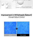 Niacinamide 21 Pore Serum - 2025 Version - 50ml