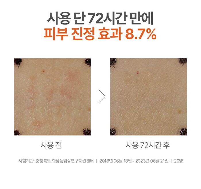 a. solution Acne Clear Repair Cream - 50ml