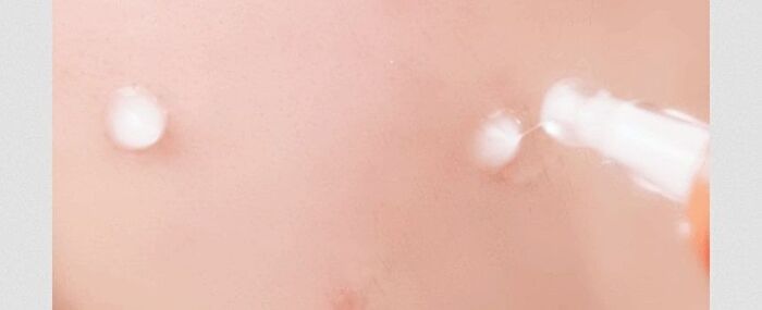 a. solution Acne Clear Spot Treatment - 25ml