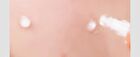 a. solution Acne Clear Spot Treatment - 25ml