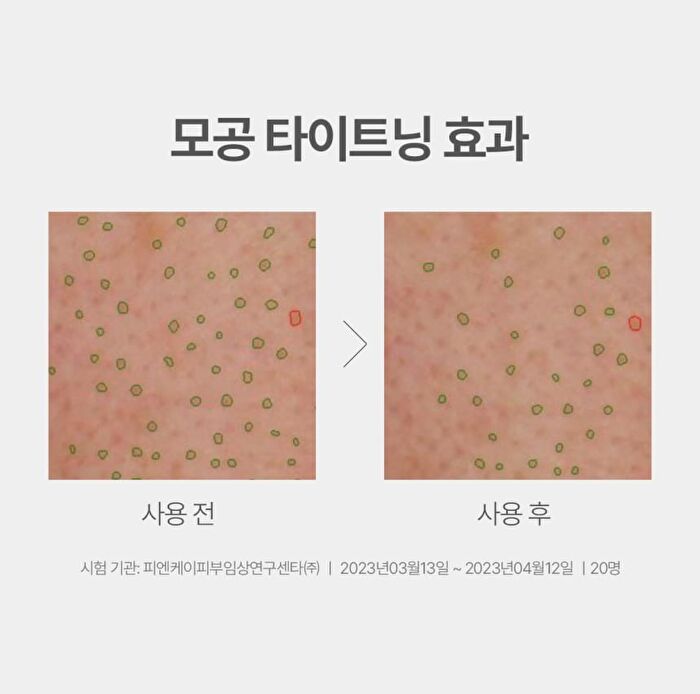 a. solution Acne Clear Toner - 200ml
