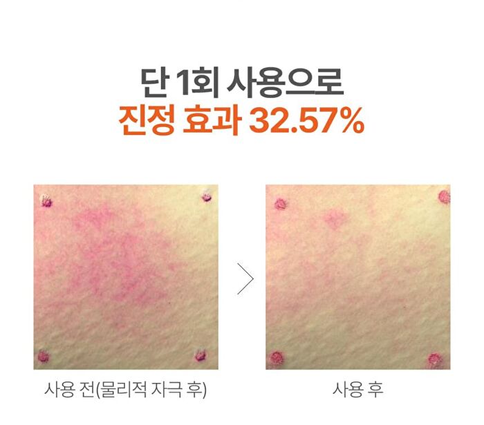a. solution Acne Clear Toner - 200ml