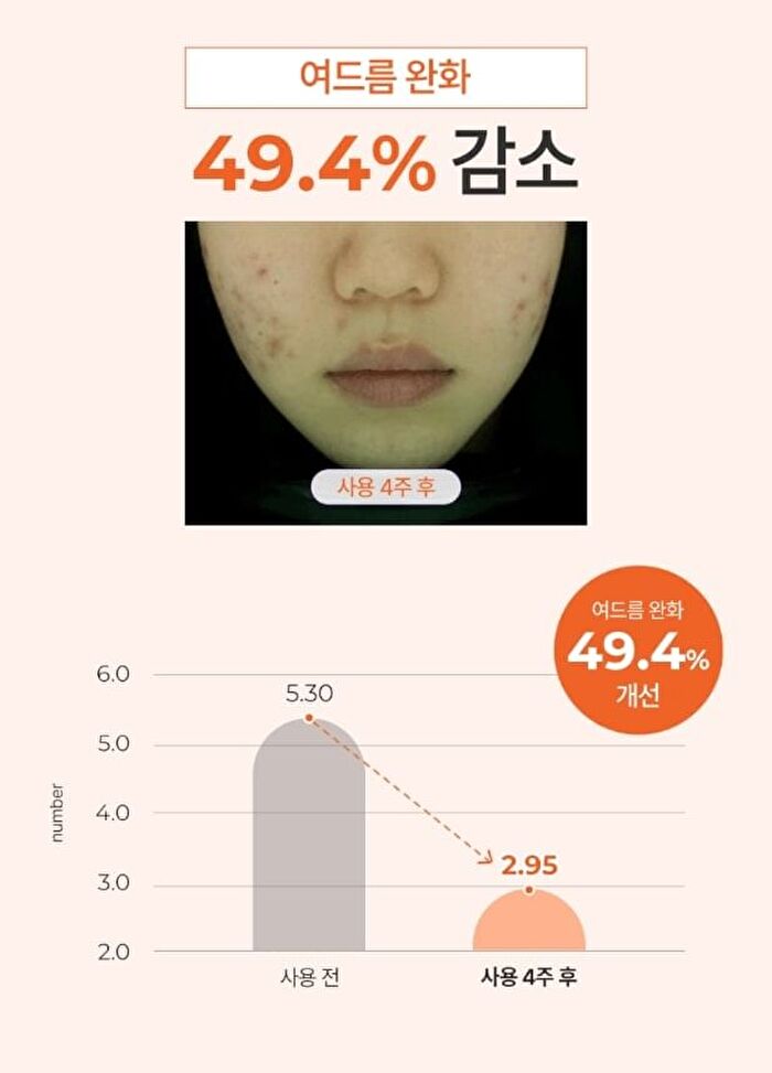 a. solution Acne Clear Cleansing Foam - 200ml