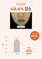 a. solution Acne Clear Cleansing Foam - 200ml
