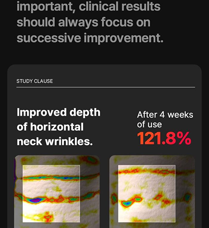 Neckcera - 1 Set