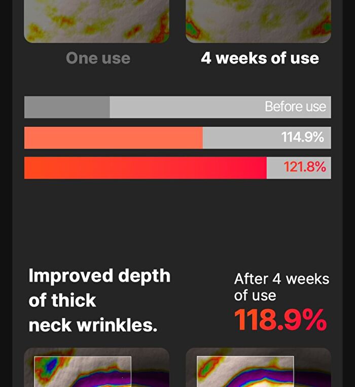 Neckcera - 1 Set