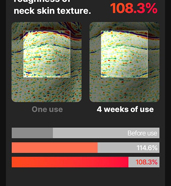 Neckcera - 1 Set