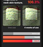 Neckcera - 1 Set