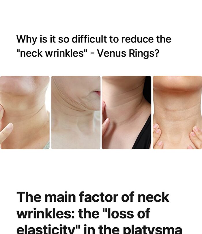 Neckcera - 1 Set