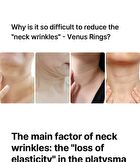 Neckcera - 1 Set