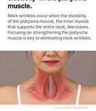 Neckcera - 1 Set