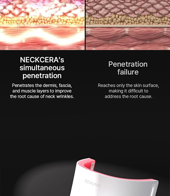 Neckcera - 1 Set