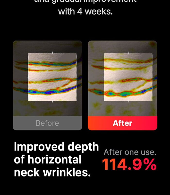 Neckcera - 1 Set