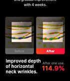 Neckcera - 1 Set