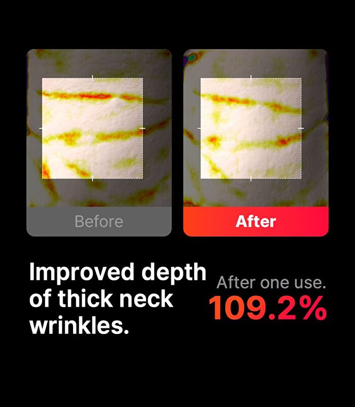 Neckcera - 1 Set