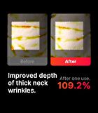 Neckcera - 1 Set