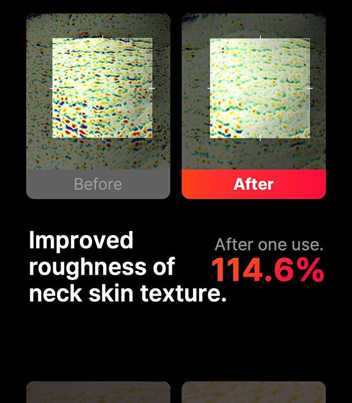 Neckcera - 1 Set