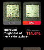 Neckcera - 1 Set