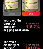 Neckcera - 1 Set
