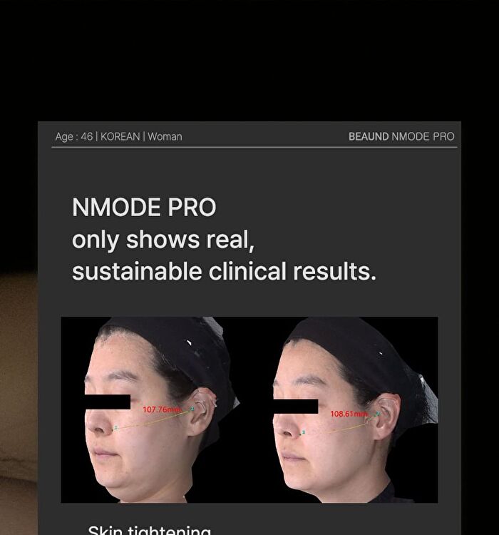 Nmode Pro - 1 Set