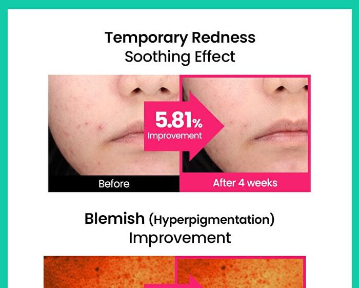 Cicaterol Blemish Pad - 2025 Version - 80 pads
