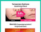 Cicaterol Blemish Pad - 2025 Version - 80 pads