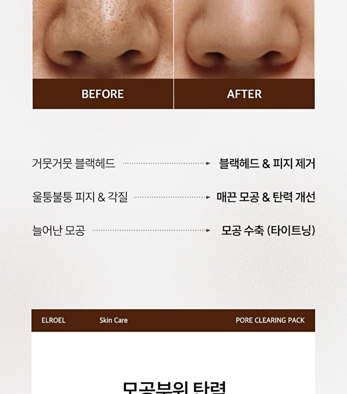 Pore Melting Pad - 60 pads