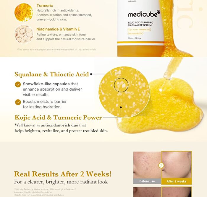 Kojic Acid Turmeric Niacinamide Serum - 30ml